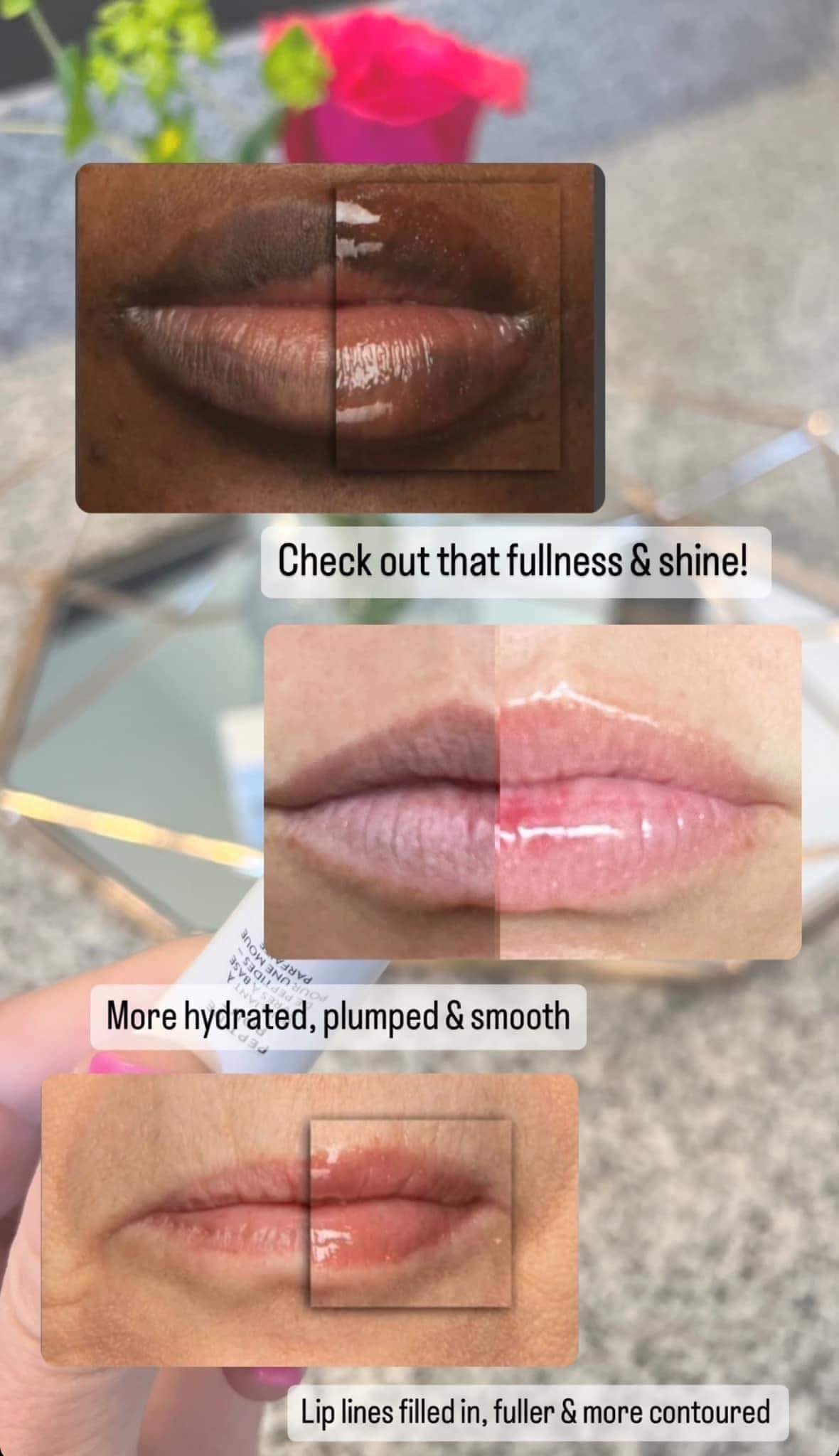 Peptide Lip Plump