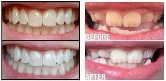 Whitening Toothpaste