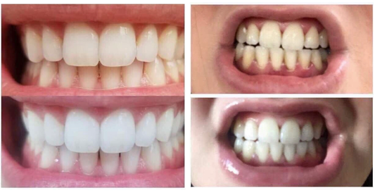 2 for 45 Whitening Toothpaste